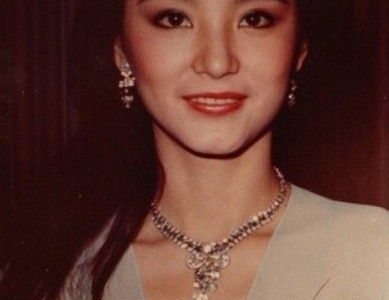 骨折未必要手术选对疗法很重要:xc sports(图2) xc sports