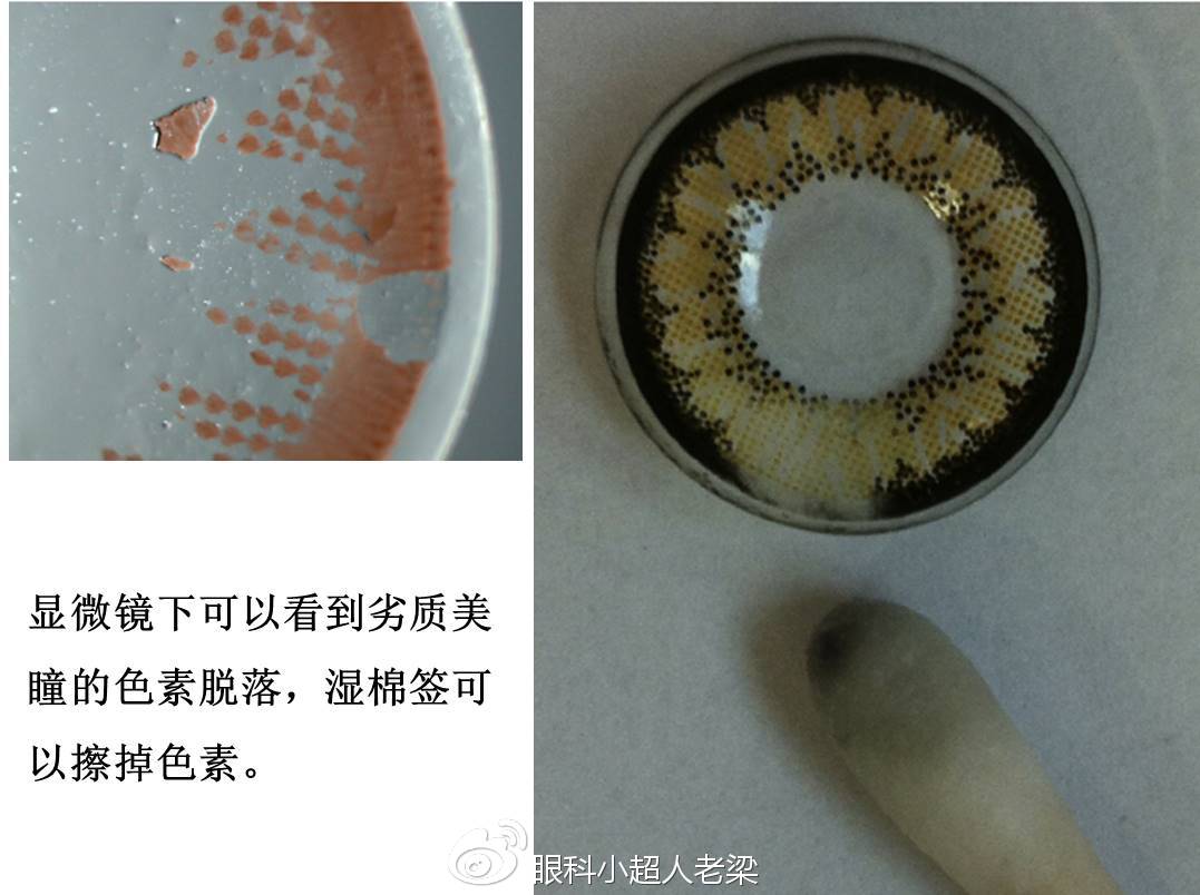 偏头痛的症状表现是什么如何及时改善|xc sports(图1) xc体育