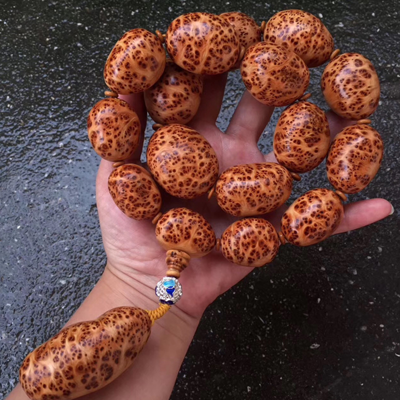 沈阳女性外阴白斑患者治疗时应注意什么?‘xc sports’(图1) xc体育